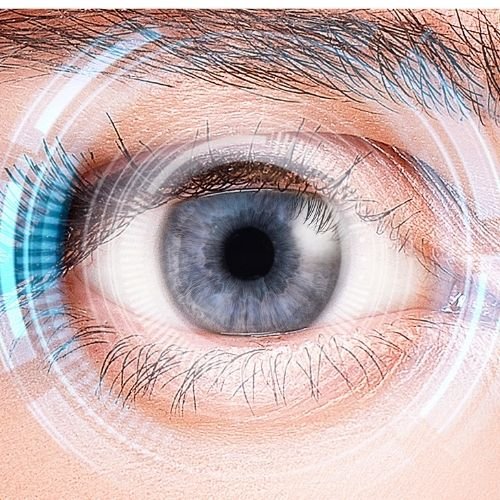 Faco+Lente Intraocular Multifocal