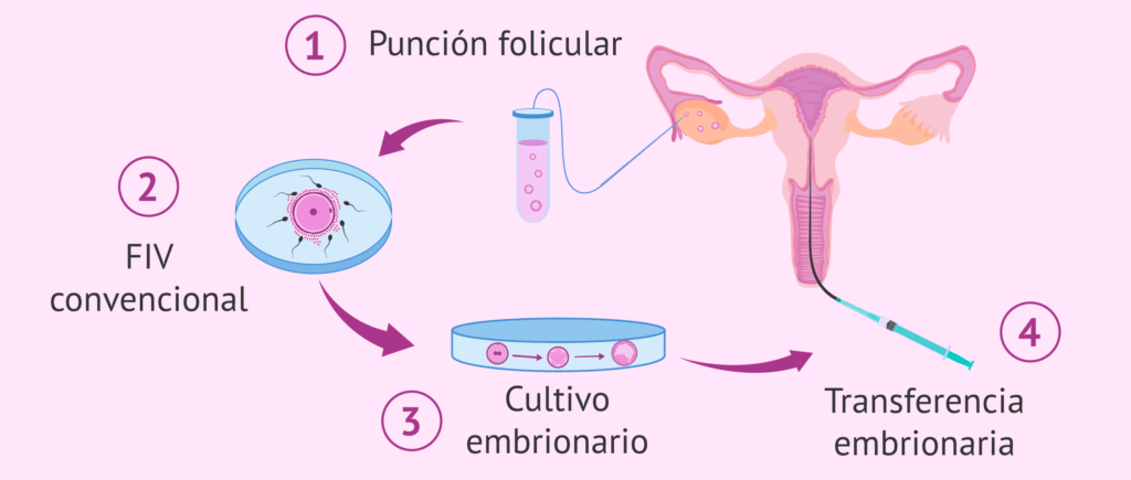 10 procedimientos médicos más demandados en México - Fertilización In Vitro (FIV)